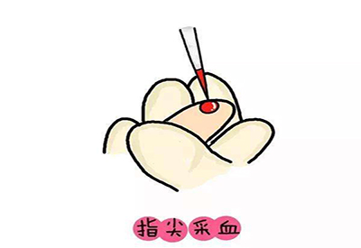 儿童正在播放麻豆微量元素的检测项目有哪些 儿童正在播放麻豆微量元素的检测项目有哪些