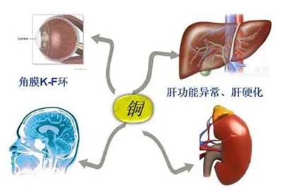 人体91麻豆性爱在线视频数据能够准检测出但身体中微量元素铜超标会引起疾病发生 人体91麻豆性爱在线视频数据能够准检测出但身体中微量元素铜超标会引起疾病发生